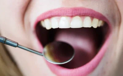 Il Migliore Idropulsore Dentale